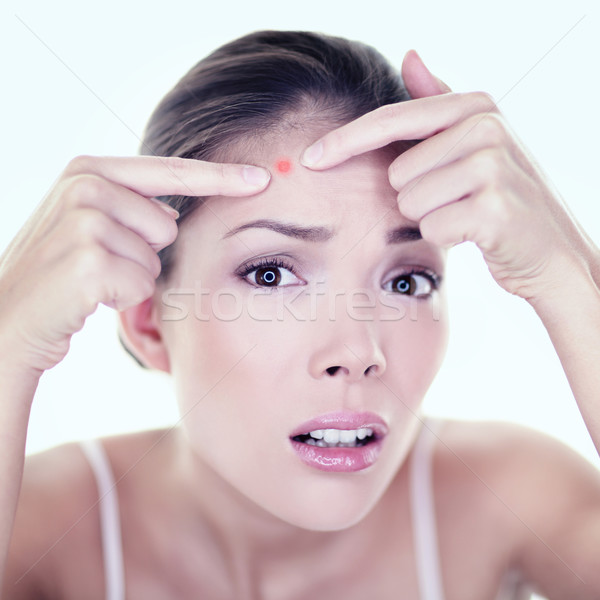 Acne pimple skin blemish spot skin care girl Stock photo © Maridav