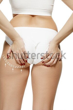Woman pinches her thigh to control cellulite Stock photo © master1305