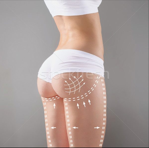 Stockfoto: Zitvlak · taille · benen · plastische · chirurgie · meisje · lichaam