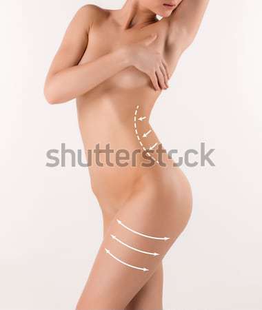 Corp corectie ajutor chirurgie plastica alb femeie Imagine de stoc © master1305