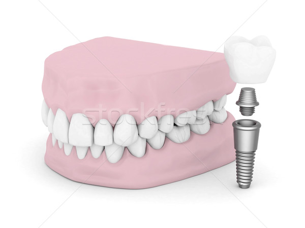 Dentar izolat alb medical proiect tehnologie Imagine de stoc © mastergarry