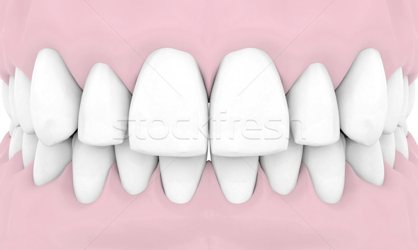 стоматологических изолированный белый медицинской дизайна технологий Сток-фото © mastergarry
