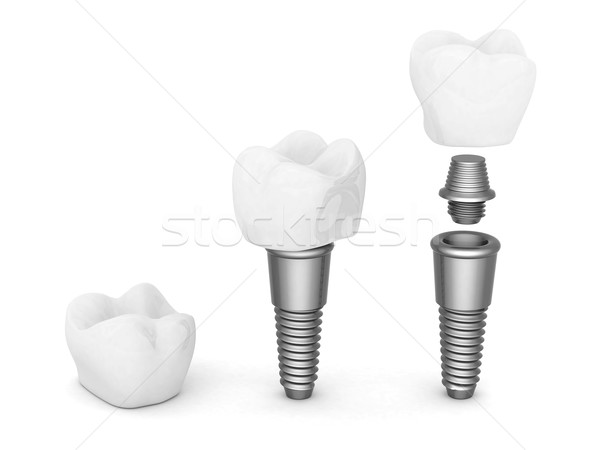 Tandheelkundige geïsoleerd witte medische ontwerp technologie Stockfoto © mastergarry