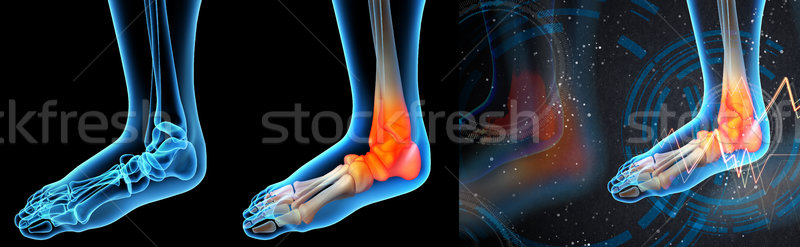 3d render illustration of the ankle pain Stock photo © maya2008
