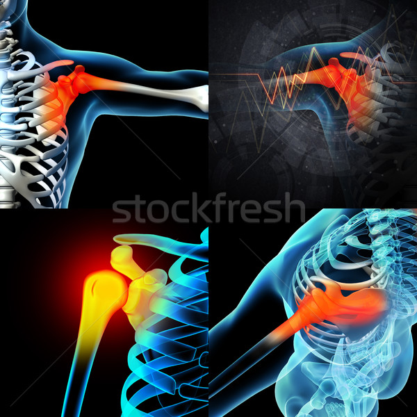 Stock photo: 3D rendering human shoulder pain with the anatomy of a skeleton 