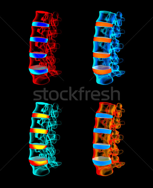 3D rendu colonne vertébrale structure noir bleu Photo stock © maya2008