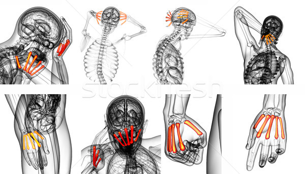 Stock photo: 3d rendering medical illustration of the metacarpal bone 