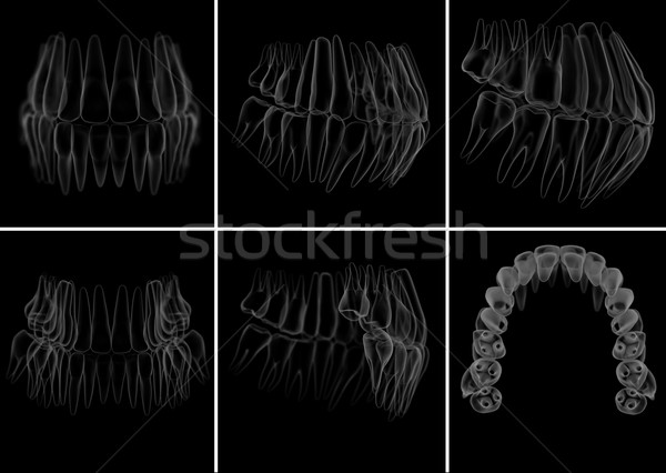 medical illustration of the tooth on  background Stock photo © maya2008