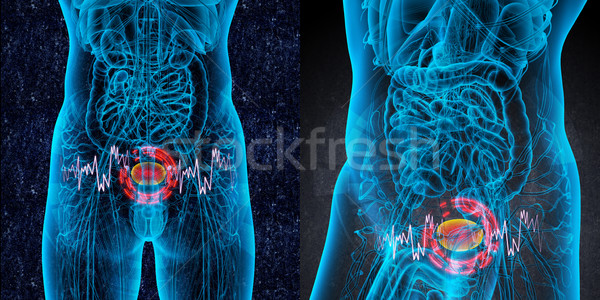 3D rendering medical illustration of the bladder pain  Stock photo © maya2008