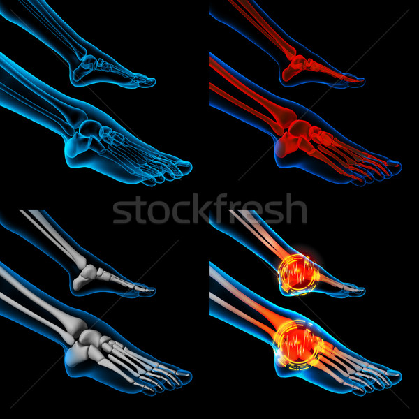 3D Rendering menschlichen Fuß Schmerzen Anatomie Stock foto © maya2008