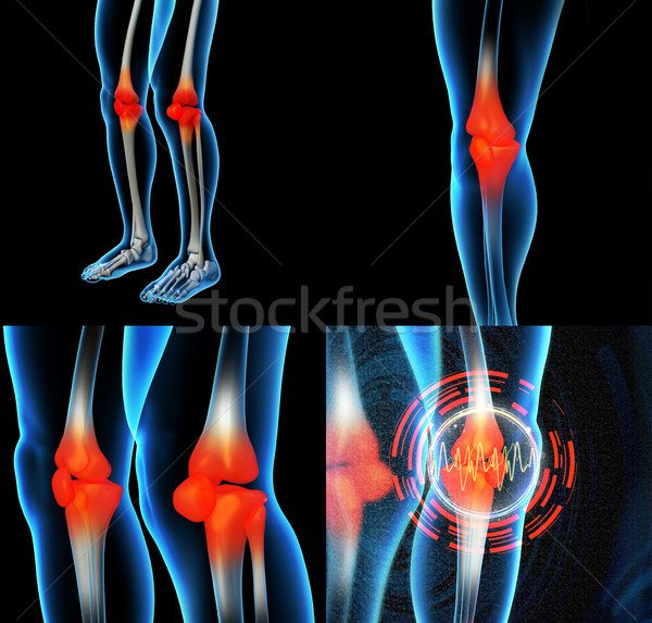 Menselijke knie pijn anatomie skelet been Stockfoto © maya2008