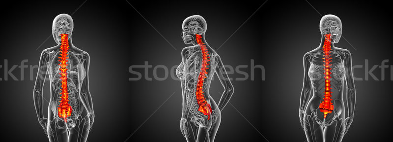 3D 醫生 插圖 人的 脊柱 商業照片 © maya2008