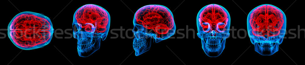 3D creierul uman raze X medical spital Imagine de stoc © maya2008