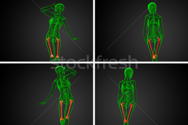 Stock photo: 3d rendering medical illustration of the femur bone 
