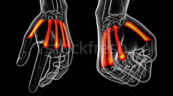 Stock photo: 3d rendering medical illustration of the metacarpal bone 