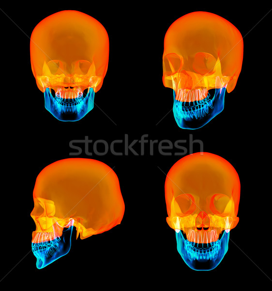 3D rendering of human Skull Upper half Stock photo © maya2008