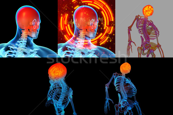 Stock foto: 3D · Rendering · Illustration · schmerzhaft · Hals · medizinischen