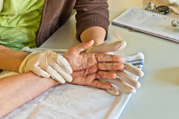 hand physiotherapy to recover a  finger Stock photo © meinzahn