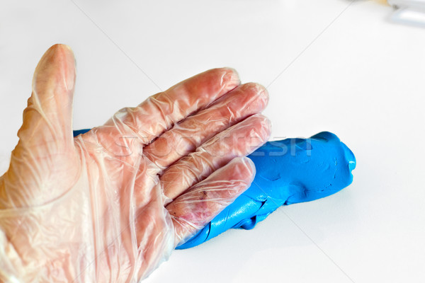 Stock photo: hand physiotherapy to recover a broken finder
