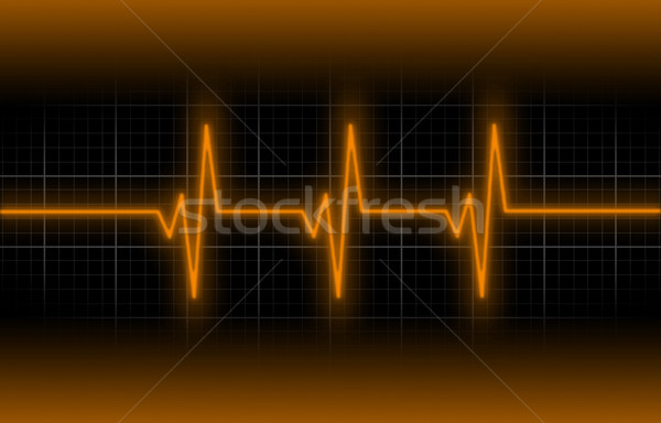 Elektrokardiogram opieki zdrowotnej bicie serca monitor medycznych ciało Zdjęcia stock © michaklootwijk