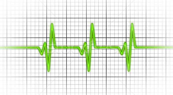 Elektrokardiogram opieki zdrowotnej bicie serca monitor medycznych ciało Zdjęcia stock © michaklootwijk