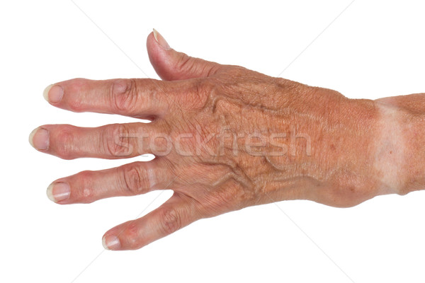 Hand of an old woman Stock photo © michaklootwijk