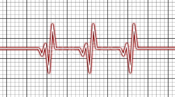 Stock photo: Electrocardiogram - Concept of healthcare