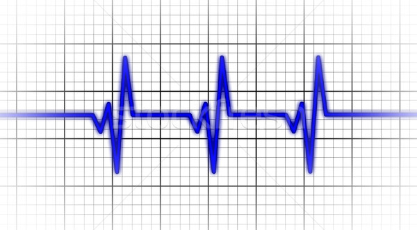 Elektrokardiogram opieki zdrowotnej bicie serca monitor medycznych ciało Zdjęcia stock © michaklootwijk