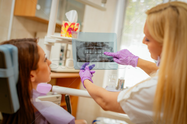 Сток-фото: стоматолога · глядя · Xray · изображение · молодые · женщины