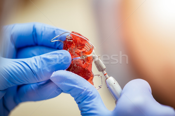 Komórkowych ortodontyczne urządzenie ręce dentysta Zdjęcia stock © MilanMarkovic78
