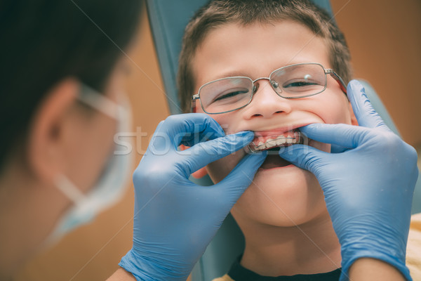 Pequeno menino dentista móvel ortodôntico dispositivo Foto stock © MilanMarkovic78