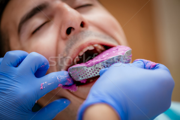Fogászati benyomás fogorvos fogszabályozó férfi beteg Stock fotó © MilanMarkovic78