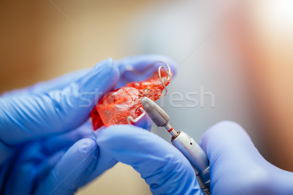 Komórkowych ortodontyczne urządzenie ręce dentysta Zdjęcia stock © MilanMarkovic78