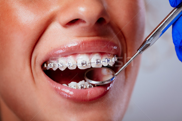 Foto stock: Suspensórios · dentista · dental · espelho · feminino
