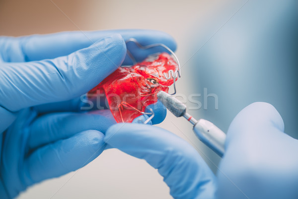 携帯 歯列矯正の アプライアンス クローズアップ 手 歯科 ストックフォト © MilanMarkovic78