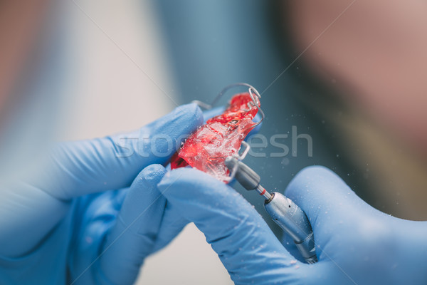 Móviles ortodoncia primer plano manos dentista Foto stock © MilanMarkovic78