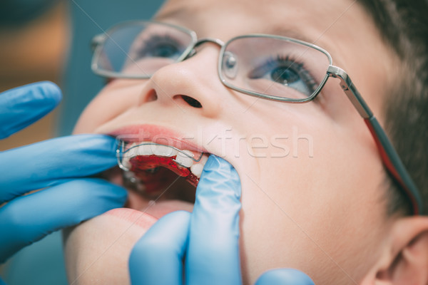 Pequeño nino dentista móviles ortodoncia Foto stock © MilanMarkovic78