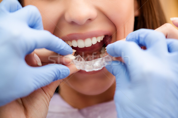 Láthatatlan fogszabályozó fogorvos mutat női beteg Stock fotó © MilanMarkovic78