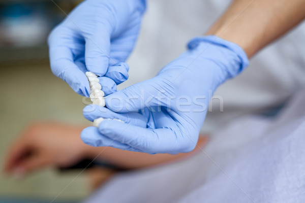 Porcelán fogak fogorvos mutat beteg közelkép Stock fotó © MilanMarkovic78