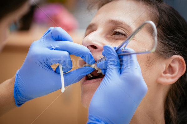 Stock foto: Hosenträger · Zahnarzt · weiblichen · Patienten · real · people