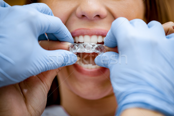 Onzichtbaar bretels tandarts tonen vrouwelijke Stockfoto © MilanMarkovic78