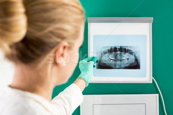 Dentysta lekarza xray obraz młodych kobiet Zdjęcia stock © MilanMarkovic78