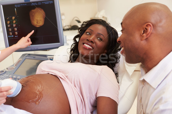 Stock photo: Pregnant Woman And Partner Having 4D Ultrasound Scan