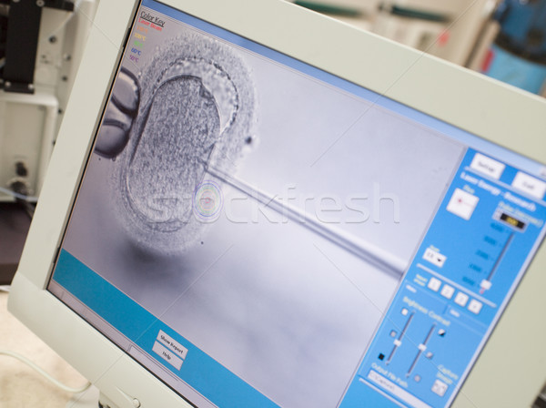 Monitor tonen sperma injectie computer laboratorium Stockfoto © monkey_business