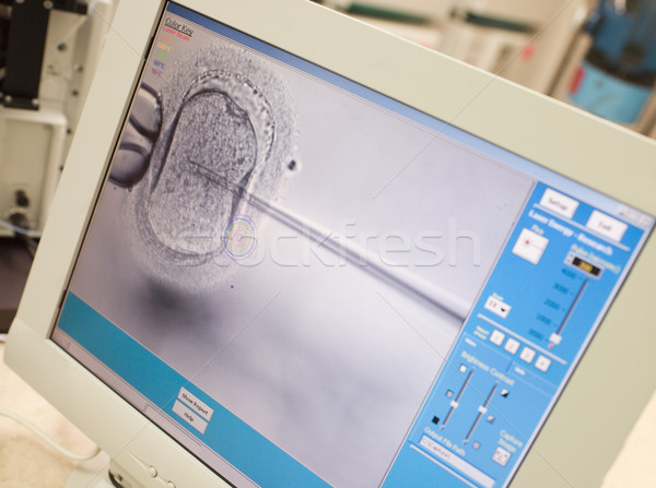 Monitor tonen sperma injectie laboratorium microscoop Stockfoto © monkey_business