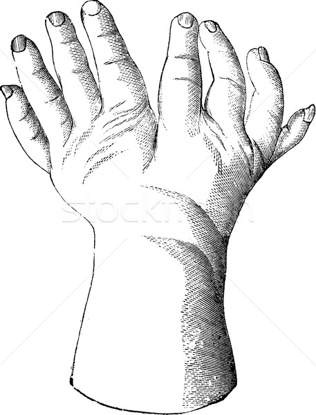 Bifurcated hand, vintage engraving. Stock photo © Morphart