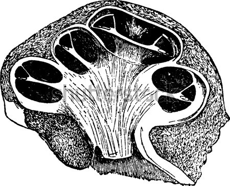 Reversal or inversion of the uterus, vintage engraving. Stock photo © Morphart
