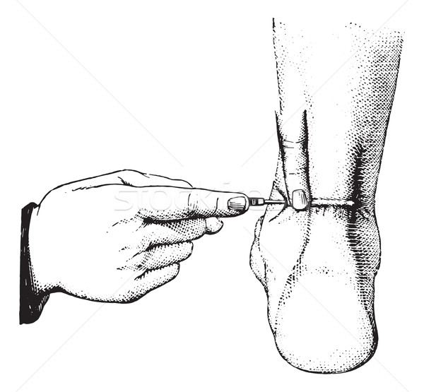 Сток-фото: сухожилие · Vintage · иллюстрация · медицина