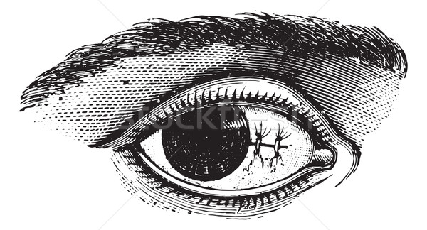 Suture of the conjunctiva after excision of pterygium, vintage e Stock photo © Morphart