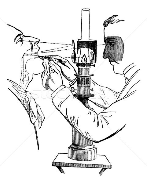 Laryngoscope, vintage engraving Stock photo © Morphart